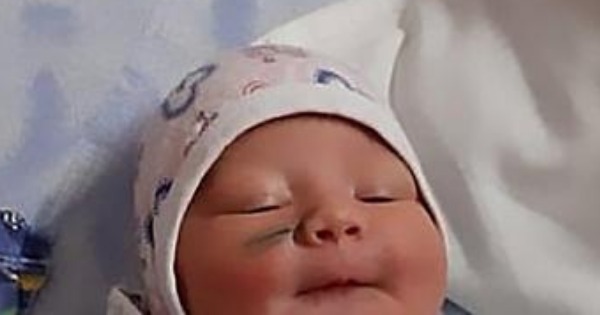 剖腹生产脸上现疤 医生辩称女婴不应乱动