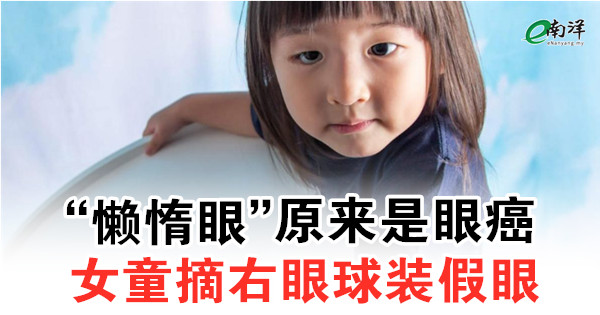 “懶惰眼”原來是眼癌 女童摘右眼球裝假眼