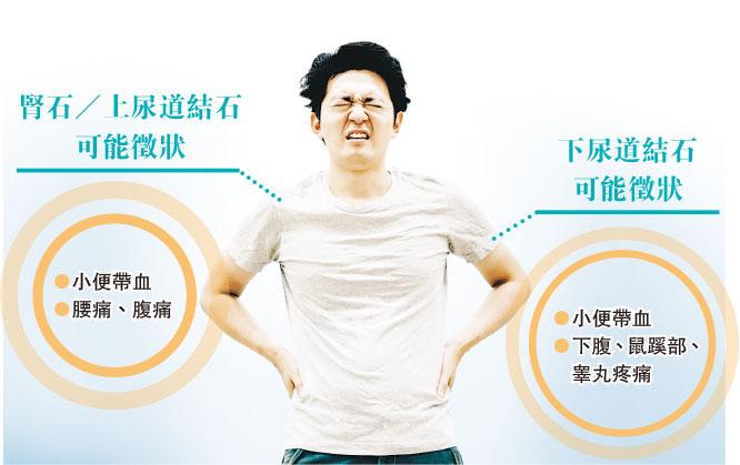 这么做可减少肾结石……