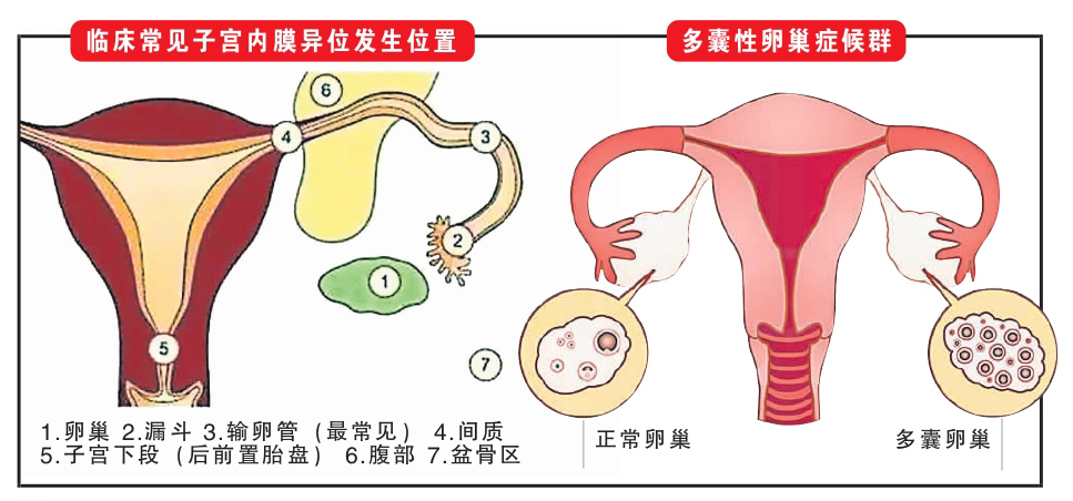 子宮