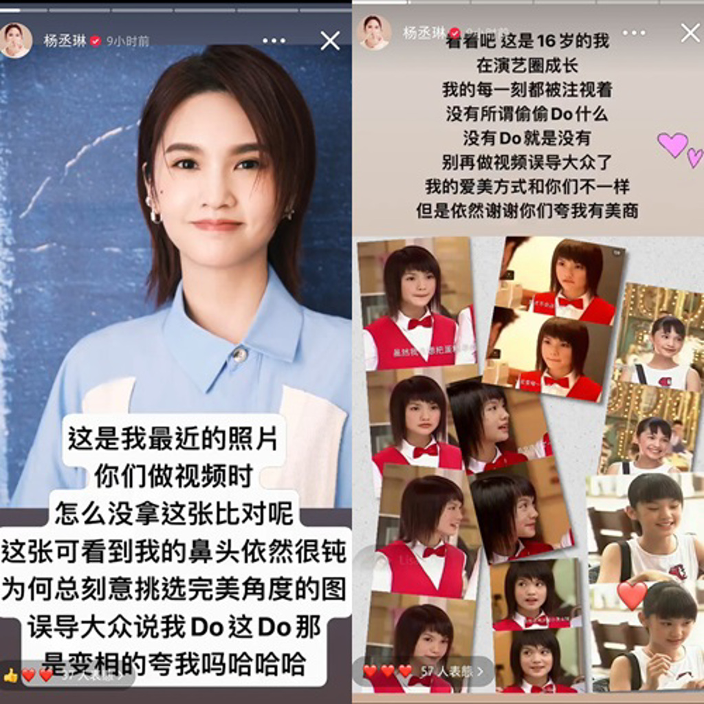 杨丞琳, 整容, 流星花园, 小红书,