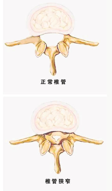 颈椎