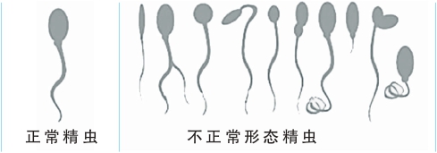 精子