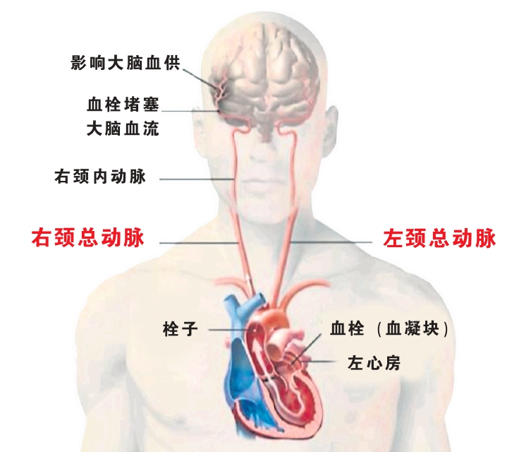 心房顫動