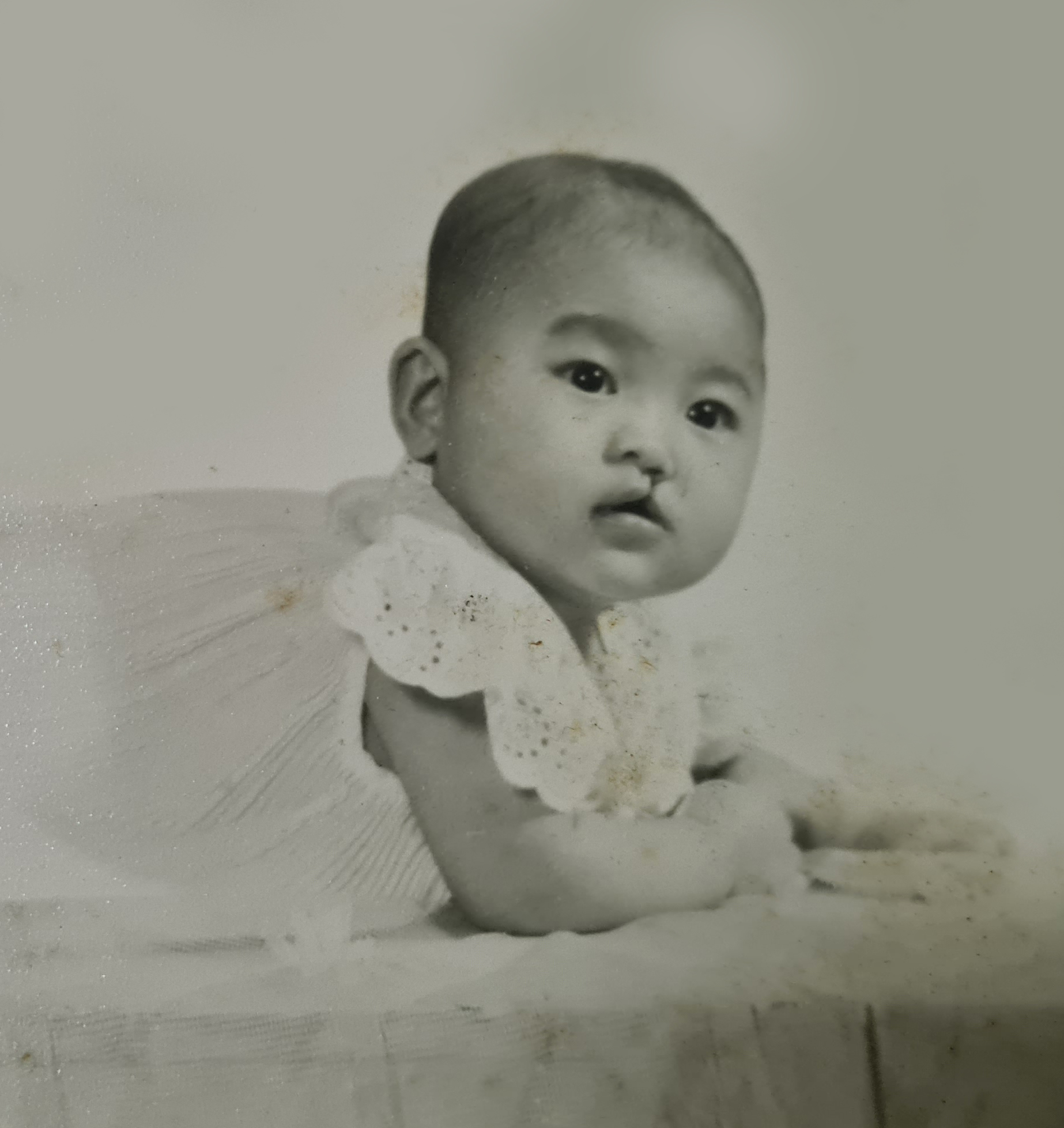 李慧敏 唇裂