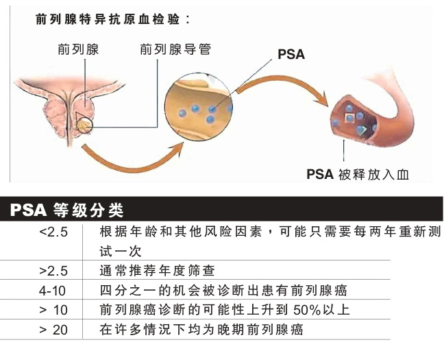 前列腺癌 图表