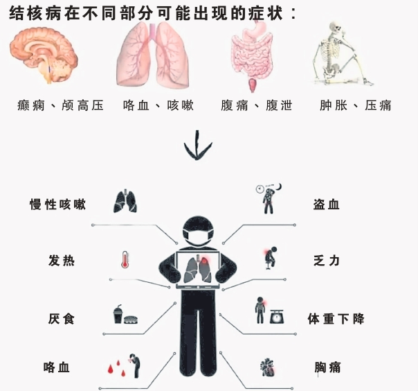结核病