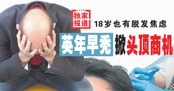 秃头商机