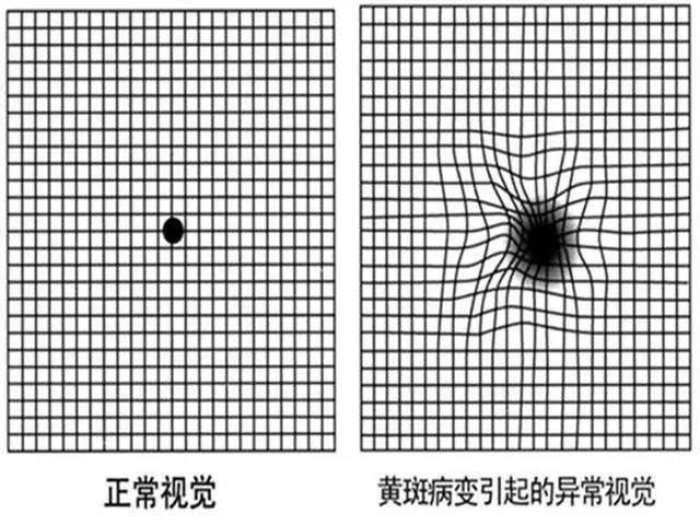 视觉