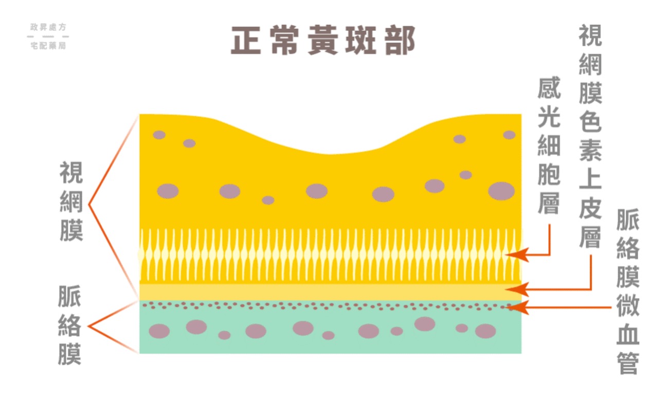 黄斑1