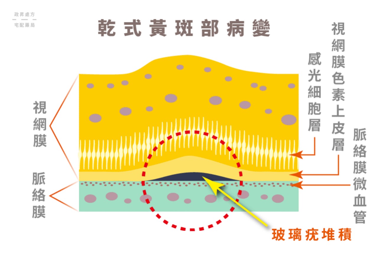 黄斑2