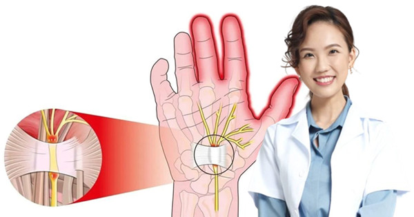 长期使用电子产品 或引发腕管综合症