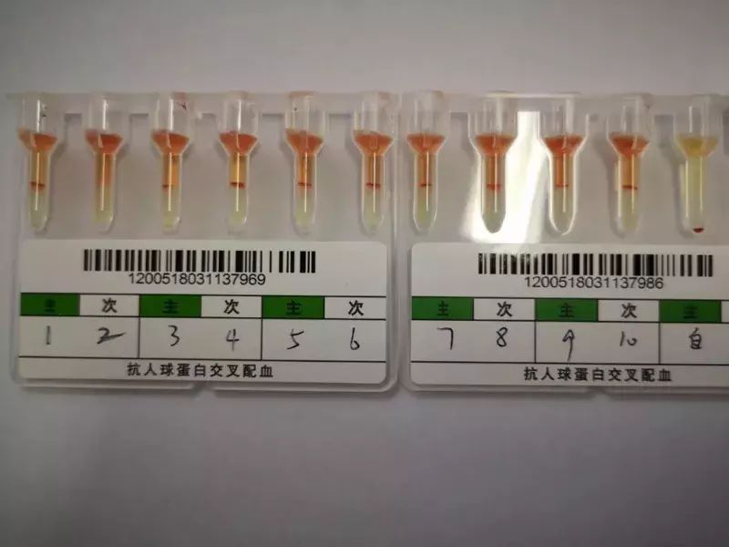 比恐龍血更罕見 江蘇發現稀有小p血型