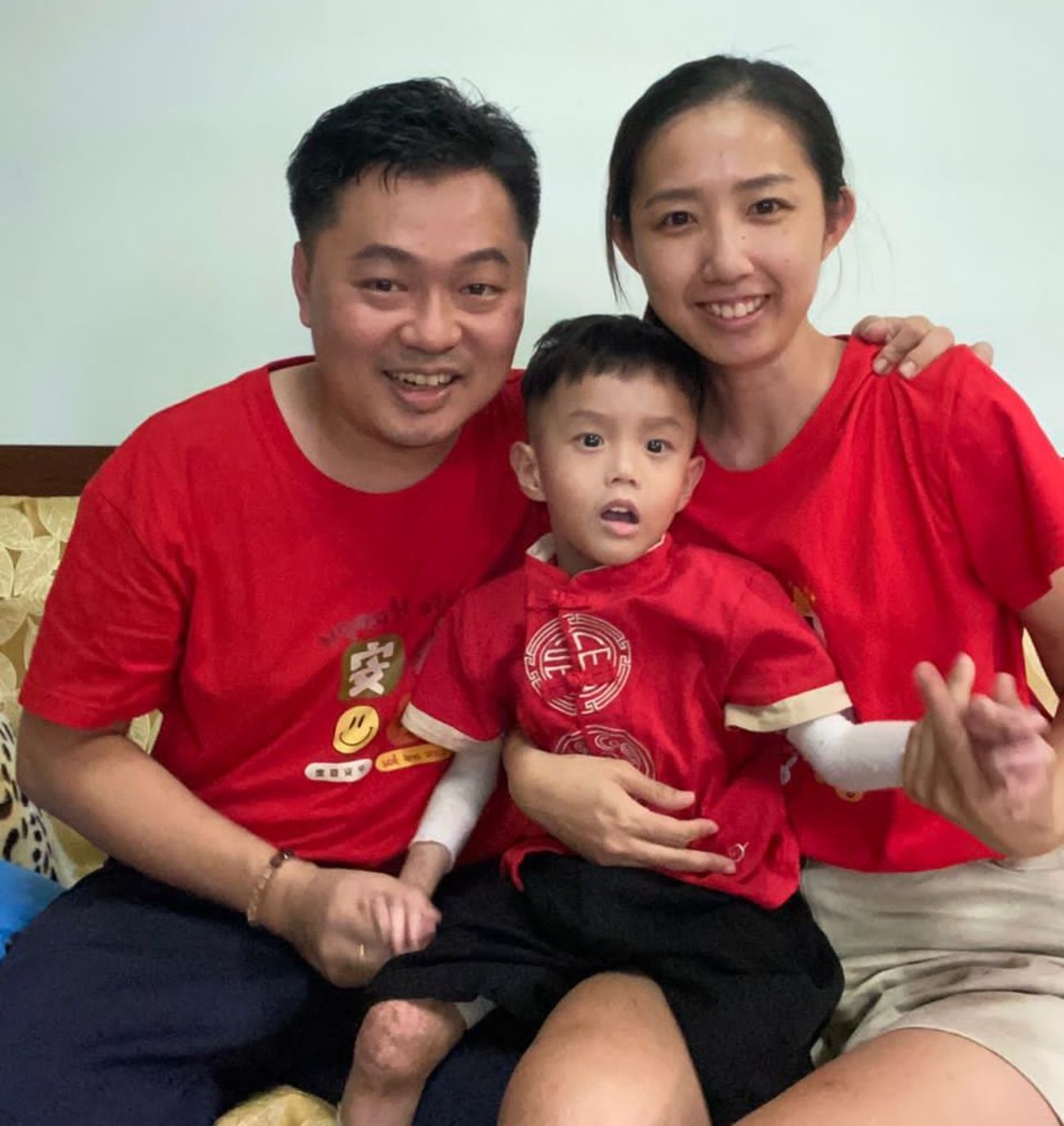 皮膚表層易脫落起泡 “蝴蝶寶寶”需要社會關愛