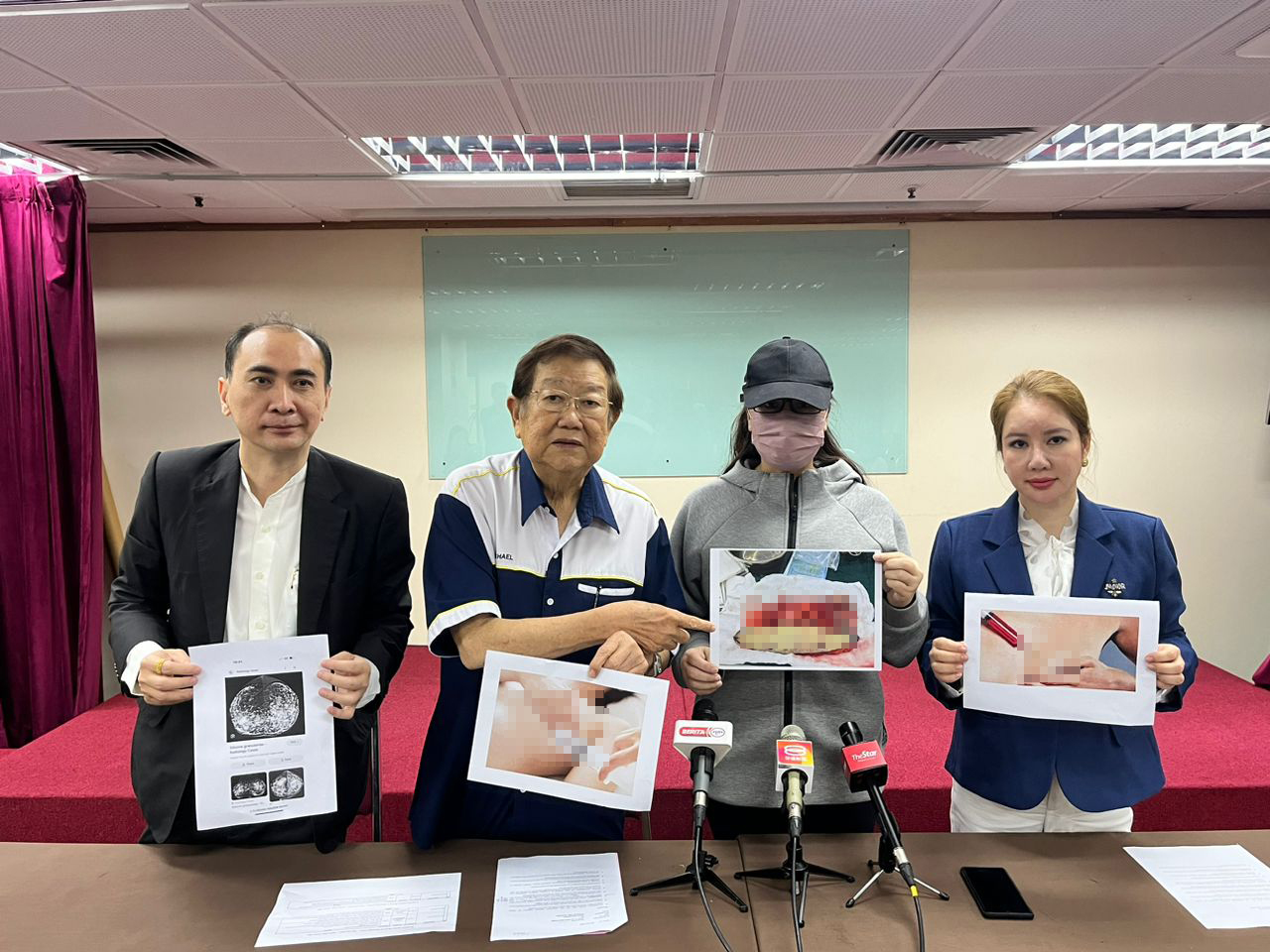 20年前隆胸留隐患 女销售顾问花2.5万“拆弹”
