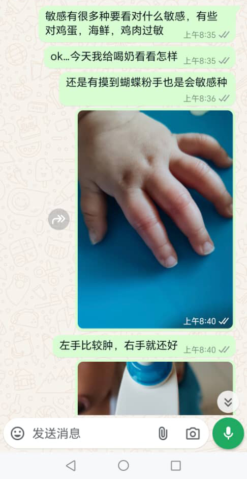 疑疏忽致女童脑死案