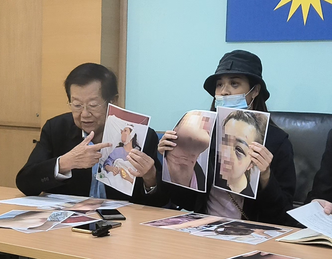 提醒调闹钟换毒打 女子痛诉男友家暴
