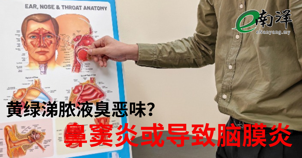 黄绿涕脓液臭恶味? 鼻窦炎或导致脑膜炎
