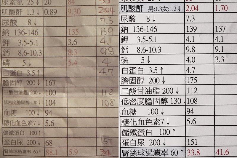 王喜患急性肾衰竭