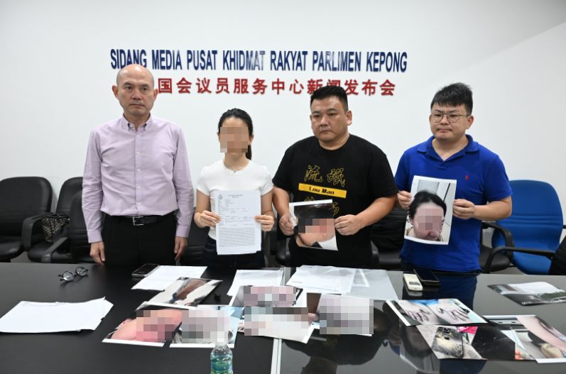 导致骨折重伤 女商人控诉遭闻人丈夫家暴