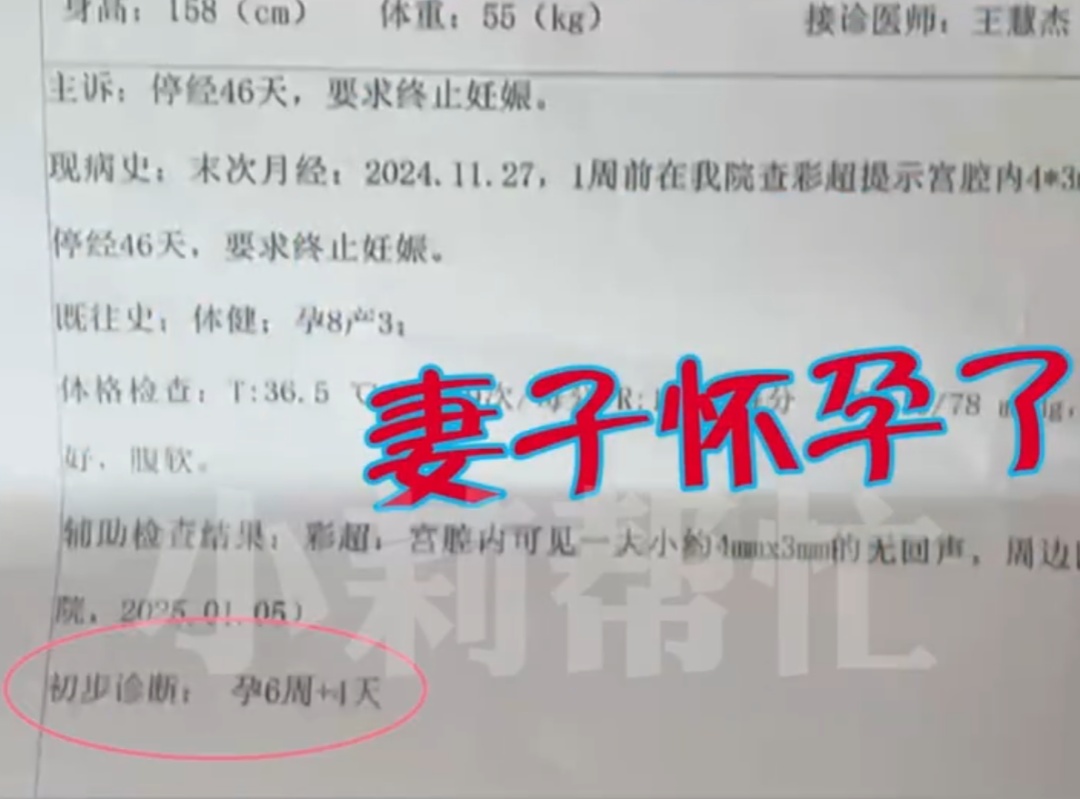 结扎3个月后妻子仍怀孕 原来是丈夫“精子太活跃”