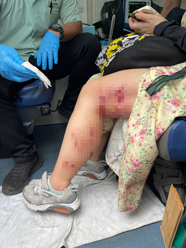 巴士疑爆胎炸开底部 中国女游客双腿受伤