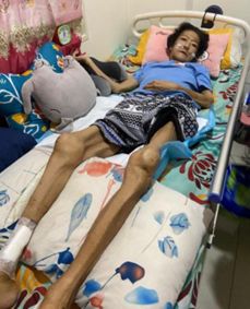 56岁单身女子中风瘫痪 肾衰末期仍坚强求生