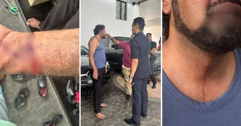 槟城海底隧道案证人遇袭 警方:属明显抢劫案
