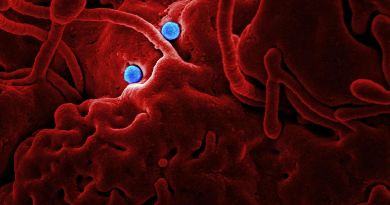 研究:肿瘤里的细菌能“杀癌” 或成新型抗癌药关键