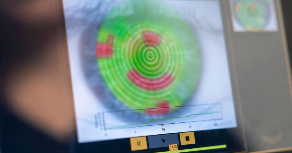 青光眼为何找上门?